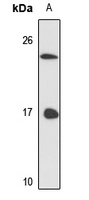 LSm3 Antibody