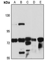 MAN1B1 Rabbit Polyclonal Antibody