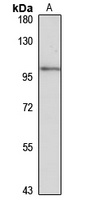 MANBA Rabbit Polyclonal Antibody