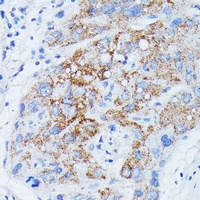 MANBA Rabbit Polyclonal Antibody