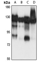 Matrin 3 Rabbit Polyclonal Antibody