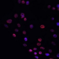 Matrin 3 Rabbit Polyclonal Antibody