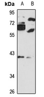 MBNL2 Rabbit Polyclonal Antibody