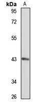 MCAT Rabbit Polyclonal Antibody
