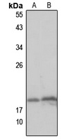 MCEE Rabbit Polyclonal Antibody