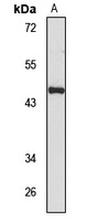 MDM4 Rabbit Polyclonal Antibody