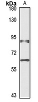 METTL13 Rabbit Polyclonal Antibody