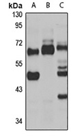 METTL14 Rabbit Polyclonal Antibody