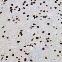 METTL14 Rabbit Polyclonal Antibody