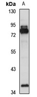 METTL16 Rabbit Polyclonal Antibody