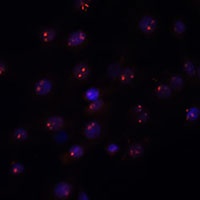 METTL16 Rabbit Polyclonal Antibody