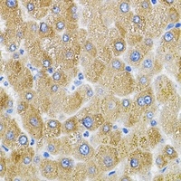 MFN2 Rabbit Polyclonal Antibody