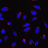MFN2 Rabbit Polyclonal Antibody