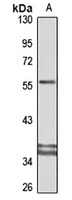 MICB Rabbit Polyclonal Antibody
