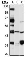 MICU2 Rabbit Polyclonal Antibody