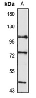 MIPEP Rabbit Polyclonal Antibody