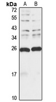 MIS12 Rabbit Polyclonal Antibody