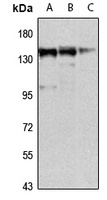 MKL1 Rabbit Polyclonal Antibody