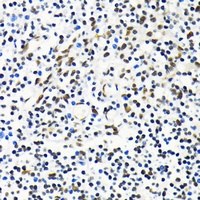 MKL1 Rabbit Polyclonal Antibody