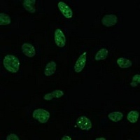MKL1 Rabbit Polyclonal Antibody