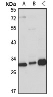 MLF2 Rabbit Polyclonal Antibody