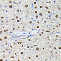 MLF2 Rabbit Polyclonal Antibody