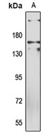 MLH3 Rabbit Polyclonal Antibody