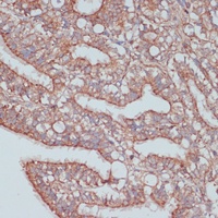 MOB4 Rabbit Polyclonal Antibody