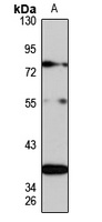 MORN1 Rabbit Polyclonal Antibody