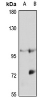 MOV10 Rabbit Polyclonal Antibody