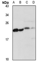 MPHOSPH6 Rabbit Polyclonal Antibody