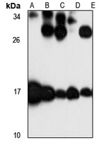 MRPL23 Rabbit Polyclonal Antibody
