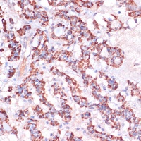 MRPL23 Rabbit Polyclonal Antibody