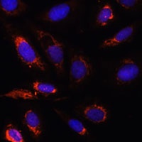 MRPL23 Rabbit Polyclonal Antibody