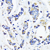 MRPL45 Rabbit Polyclonal Antibody