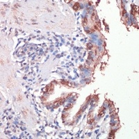 Musashi 1 Rabbit Polyclonal Antibody