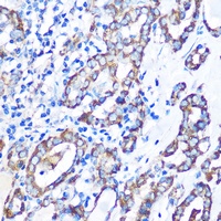 MST4 Rabbit Polyclonal Antibody
