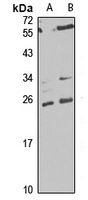 MTP18 Rabbit Polyclonal Antibody