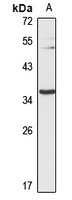MT-ND1 Rabbit Polyclonal Antibody