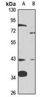 MT-ND2 Rabbit Polyclonal Antibody