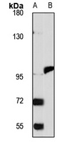 MTTP Rabbit Polyclonal Antibody