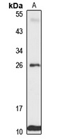 MTLC Rabbit Polyclonal Antibody