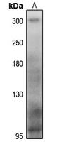 MYH13 Rabbit Polyclonal Antibody