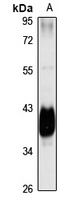 NANS Rabbit Polyclonal Antibody