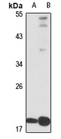 NAP1L5 Rabbit Polyclonal Antibody