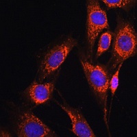 Nicastrin Rabbit Polyclonal Antibody
