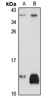 NDUFAB1 Rabbit Polyclonal Antibody