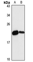 NDUFAF2 Rabbit Polyclonal Antibody