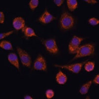 NDUFAF2 Rabbit Polyclonal Antibody