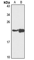 NDUFAF4 Antibody